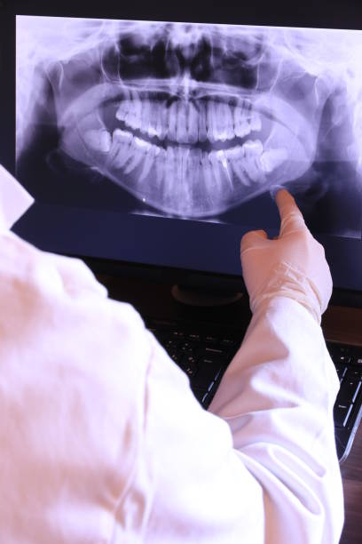 Best Emergency Dental Extractions in Matawan, NJ