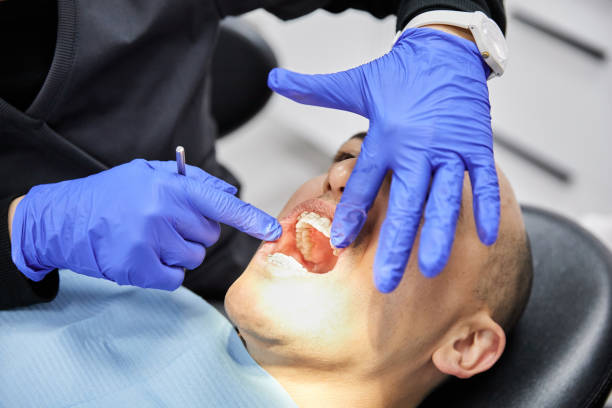 Best Emergency Dentist for Knocked-Out Tooth in Matawan, NJ